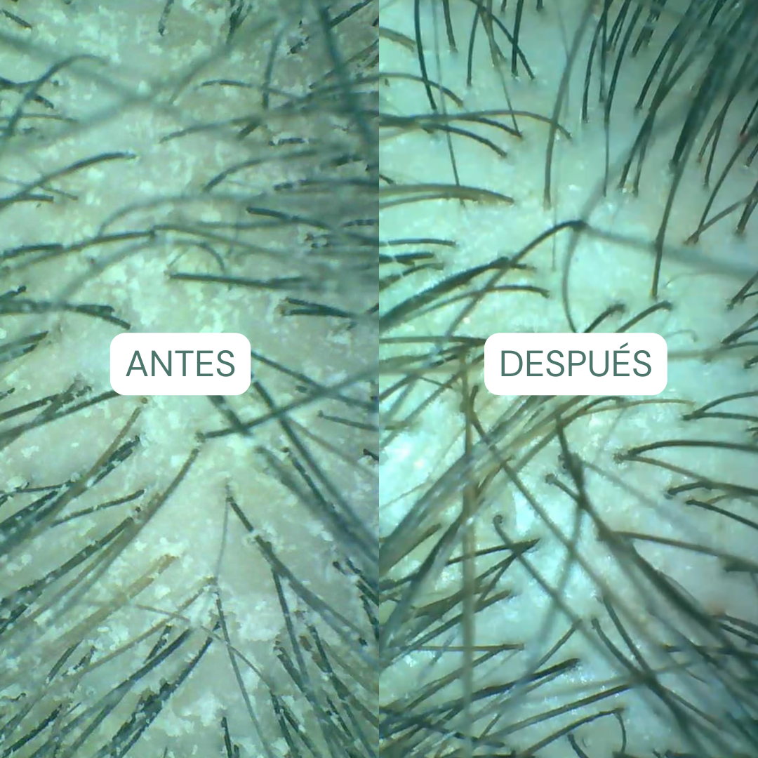 Complete detox routine for oily roots
